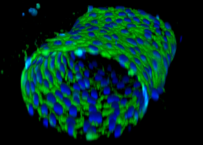 3D confocal reconstruction of a blood vessel-on-chip
